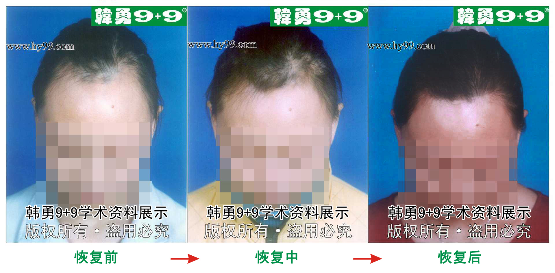 0002 HD_chanhou bj wangmin.jpg