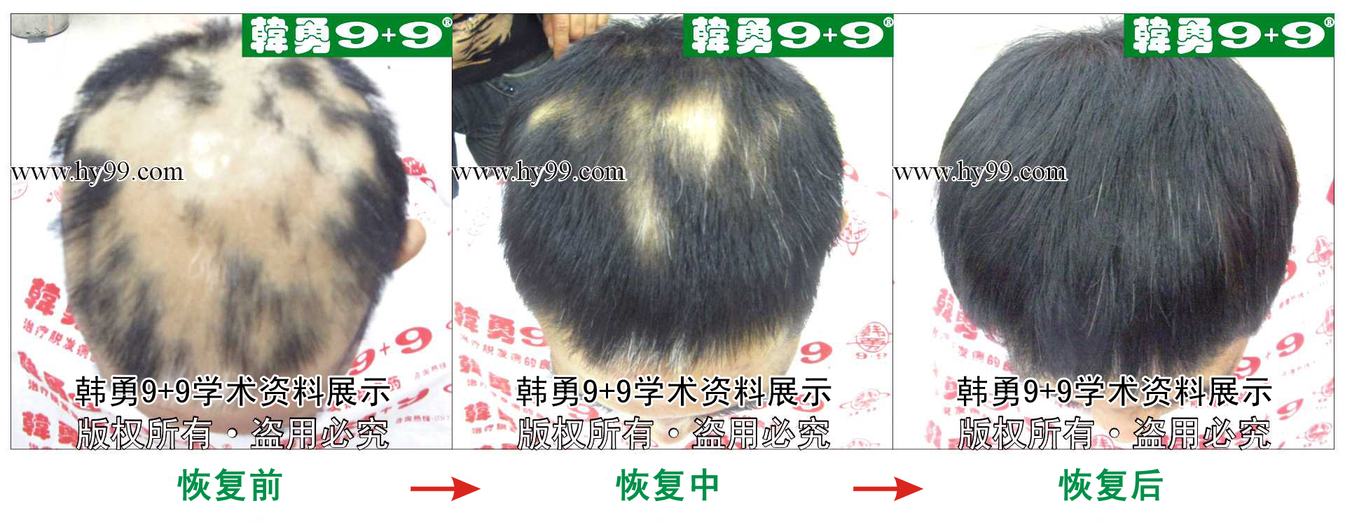 0007 HD_bantu bj107-67(1)a.jpg