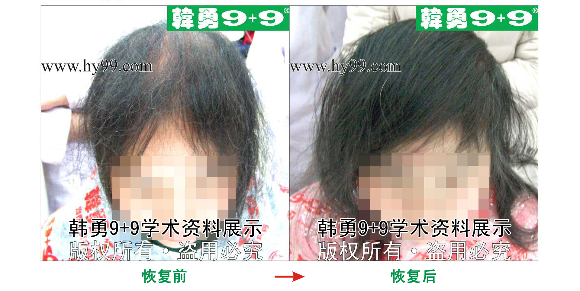 0008 HD_zhiyixing bj114-13b.jpg