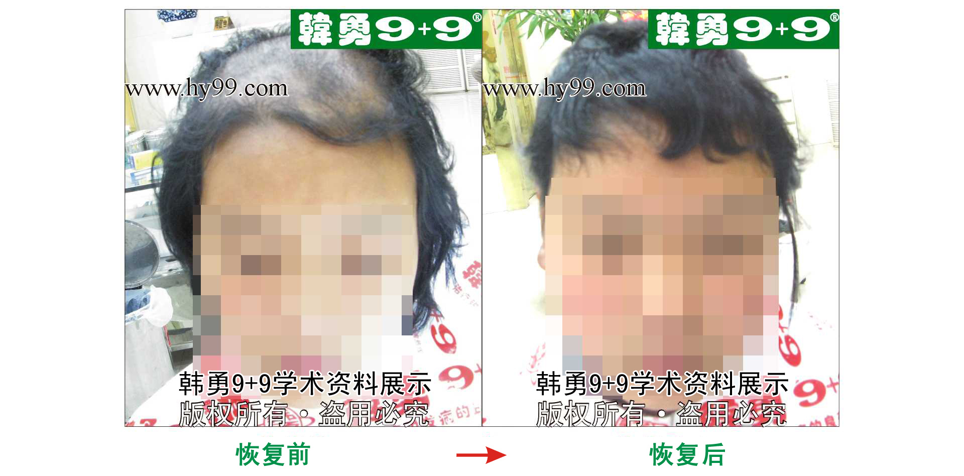 0025 HD_bantu bj134-21b.jpg