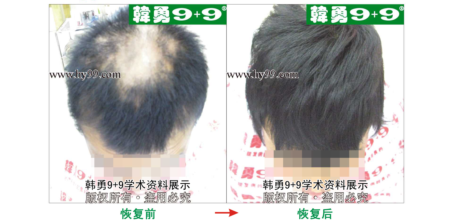 0043 HD_bantu bj151-7(1).jpg