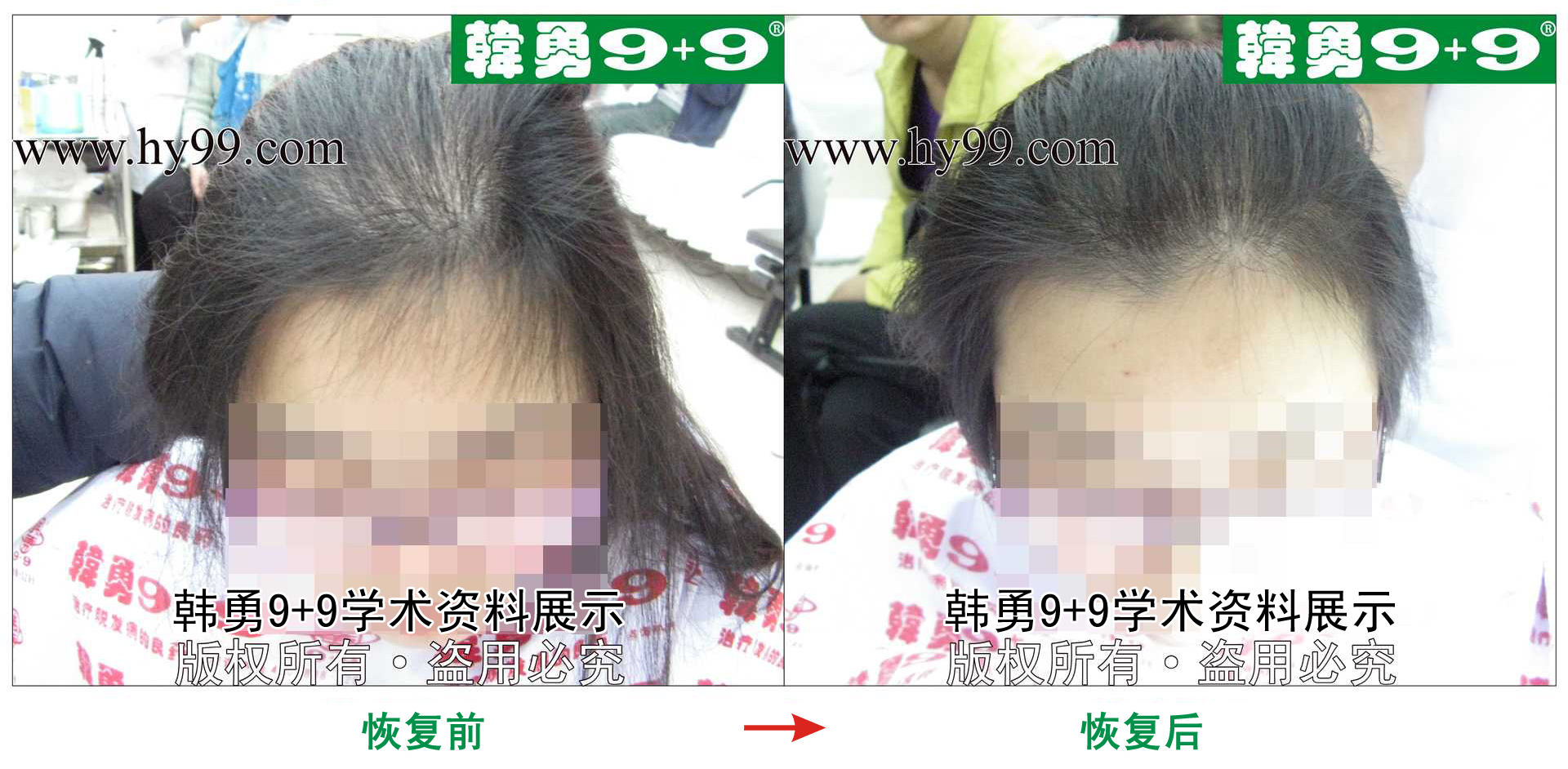 0026 HD_zhiyixing bj176-2b.jpg