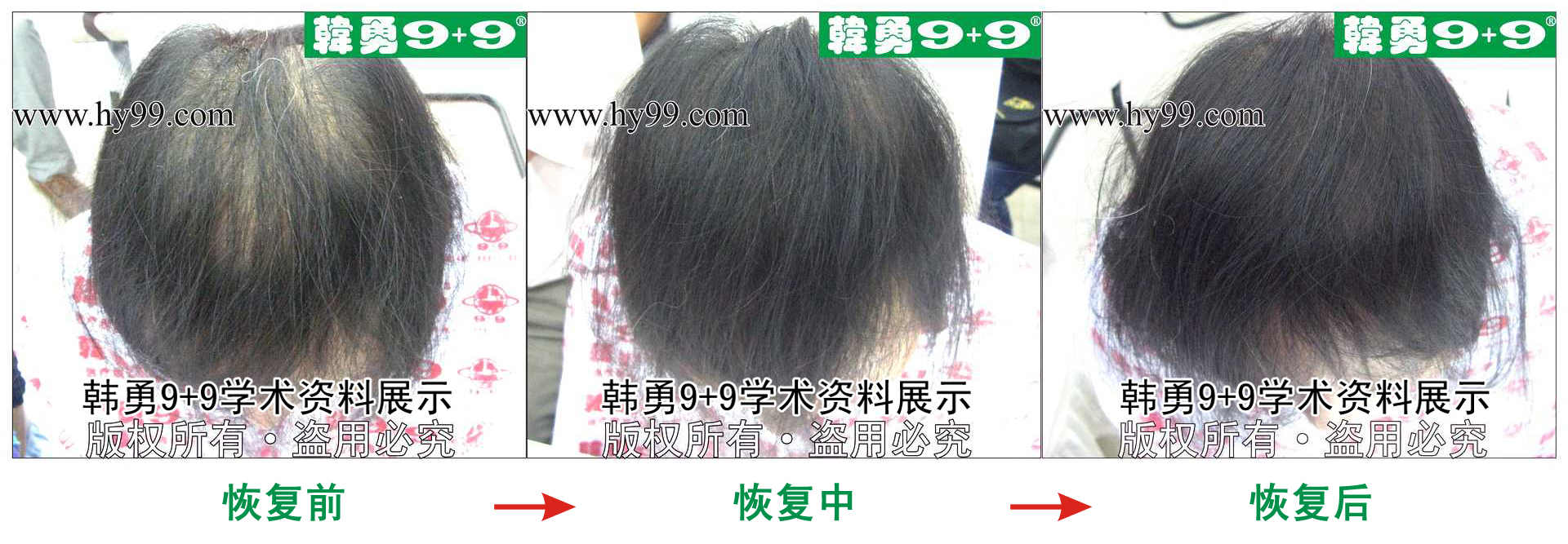 0028 HD_zhiyixing bj184-7a.jpg