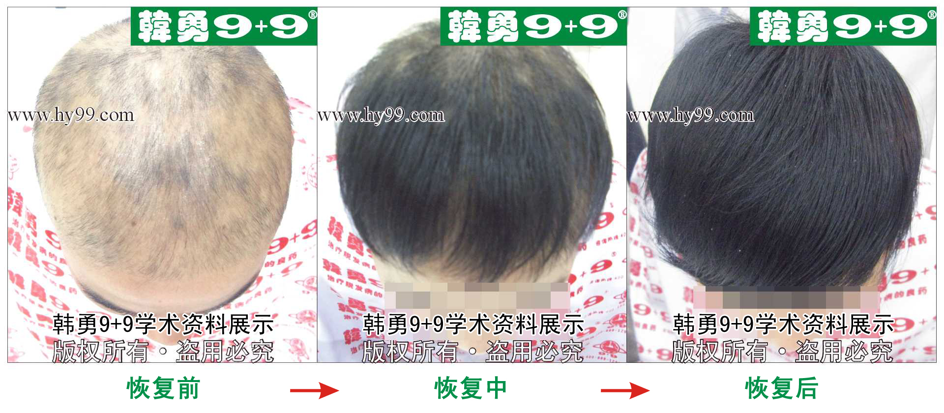 0029 HD_bantu bj140-54(1).jpg