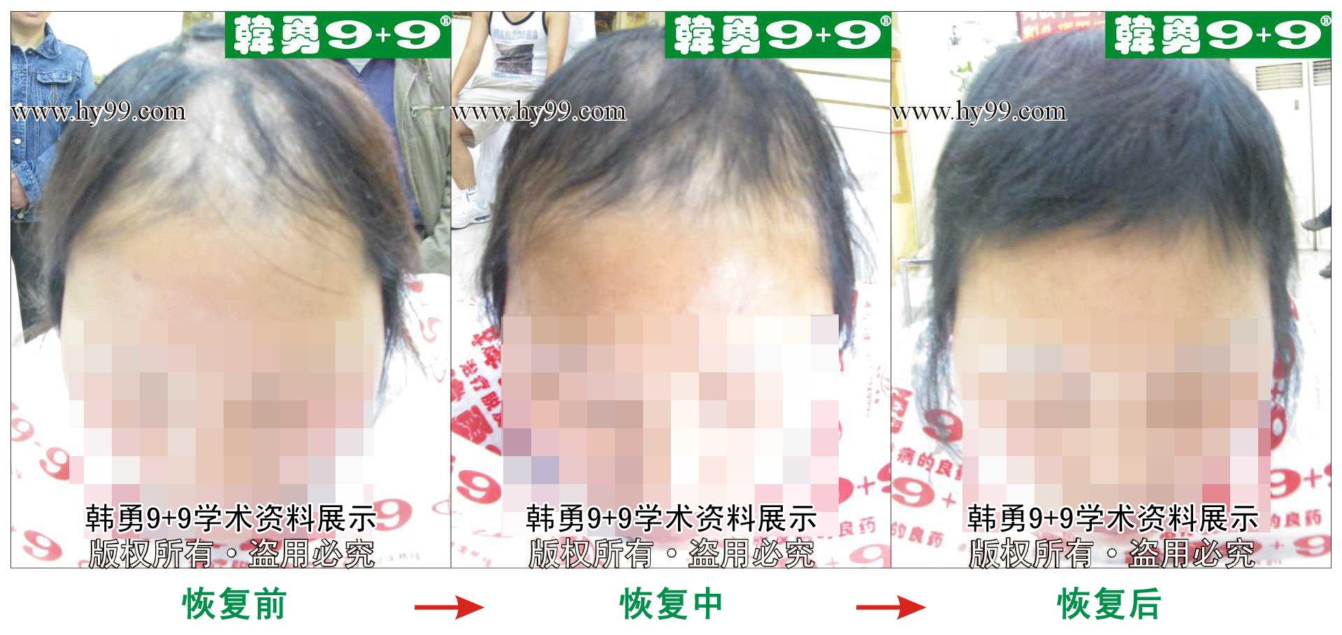 0033 HD_bantu bj144-18(1)a.jpg