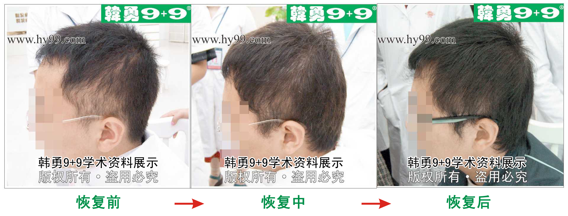 0034 HD_zhiyixing bj994-3a.jpg