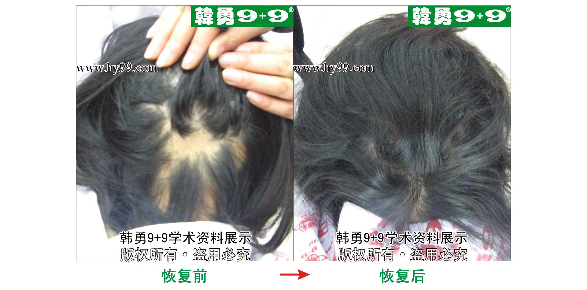 0035 HD_bantu bj144-47(2).jpg