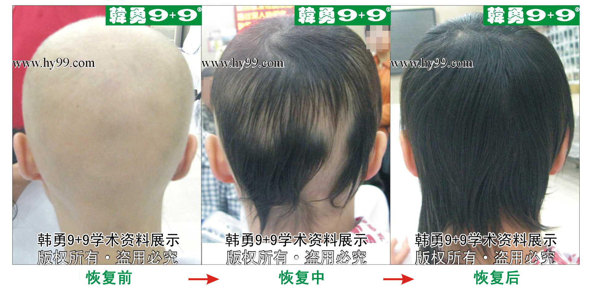 0037 HD_bantu bj144-49(1)b.jpg