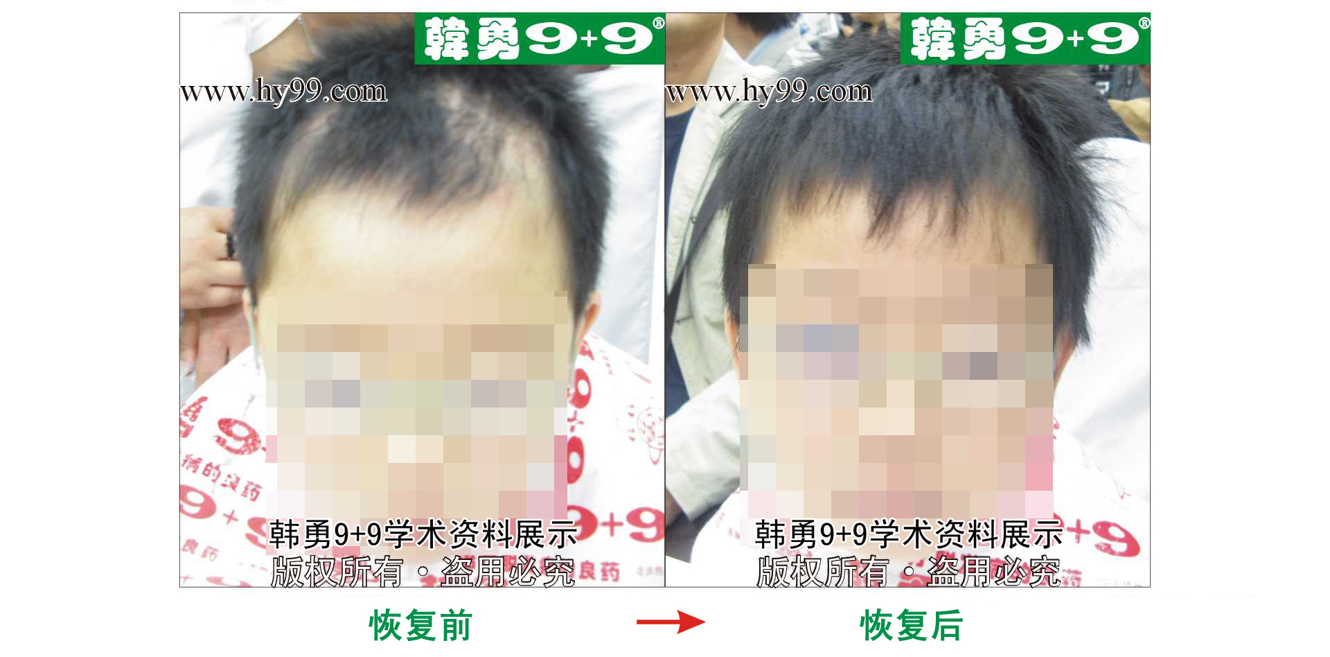 0049 HD_bantu bj155-28(2).jpg